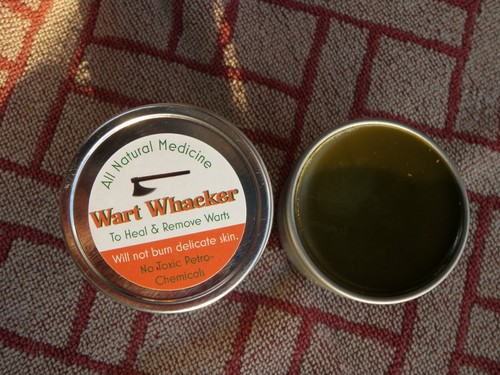 Wart remover effective - remover, &