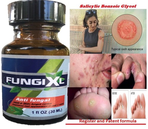 Athlete foot antifungal - athlete's,
